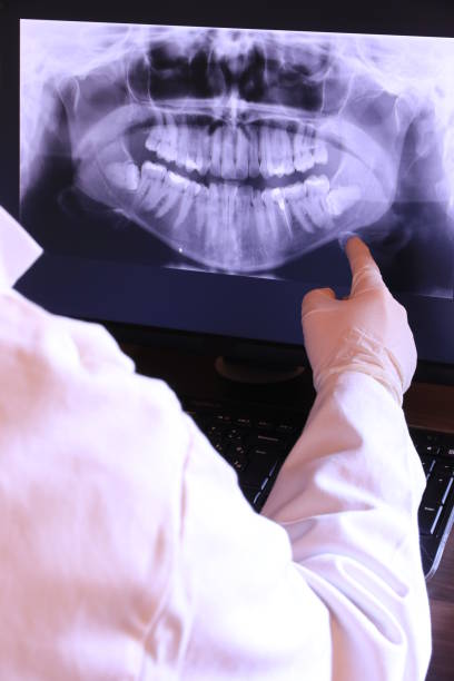 Best Emergency Dental Care for Broken or Chipped Teeth in Vassar, MI