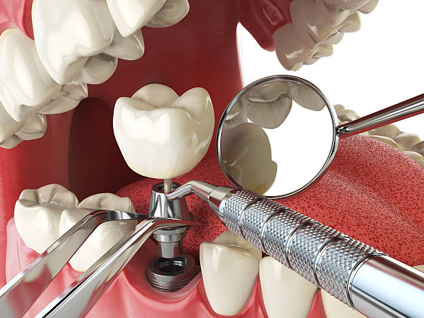 Best Weekend Emergency Dentist in Vassar, MI