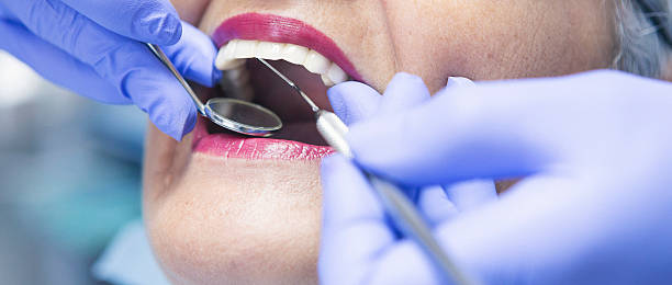 Best Emergency Dental Care for Broken or Chipped Teeth in Vassar, MI
